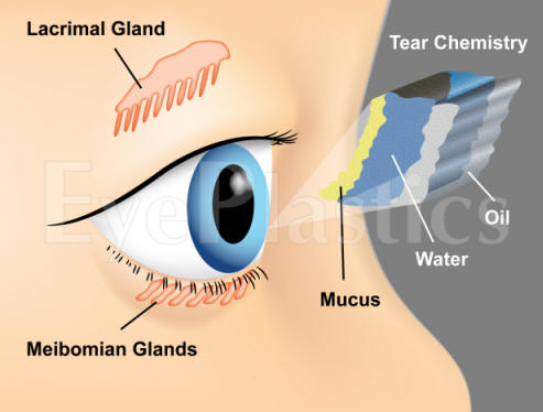 Illustration of a person with dry eyes holding eye drops
